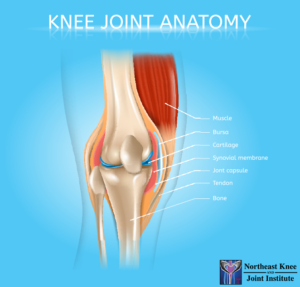 Hyaluronic Acid Injections - Northeast Knee & Joint Institute