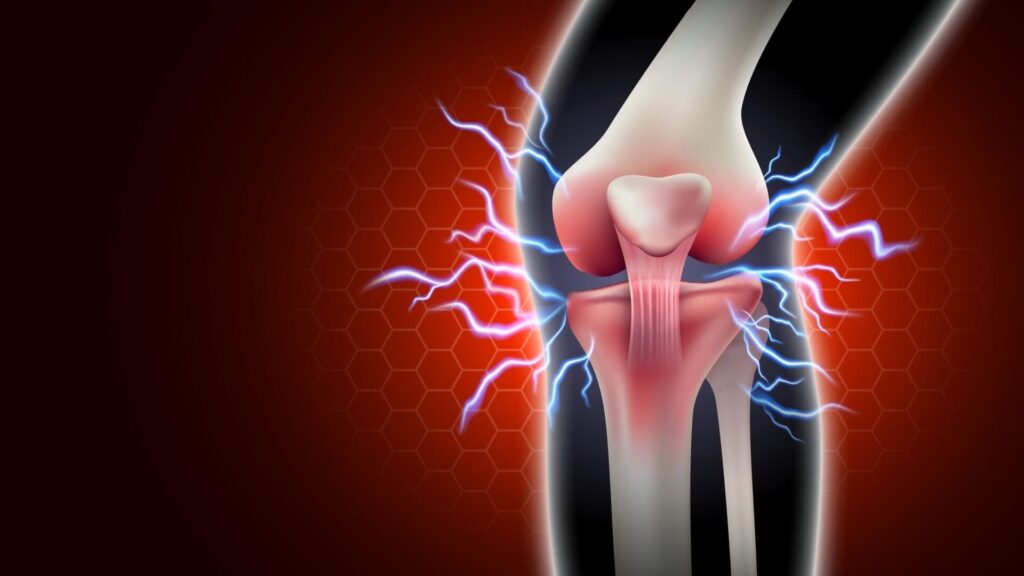 What Vitamin Do You Need If You Have Joint Pain?