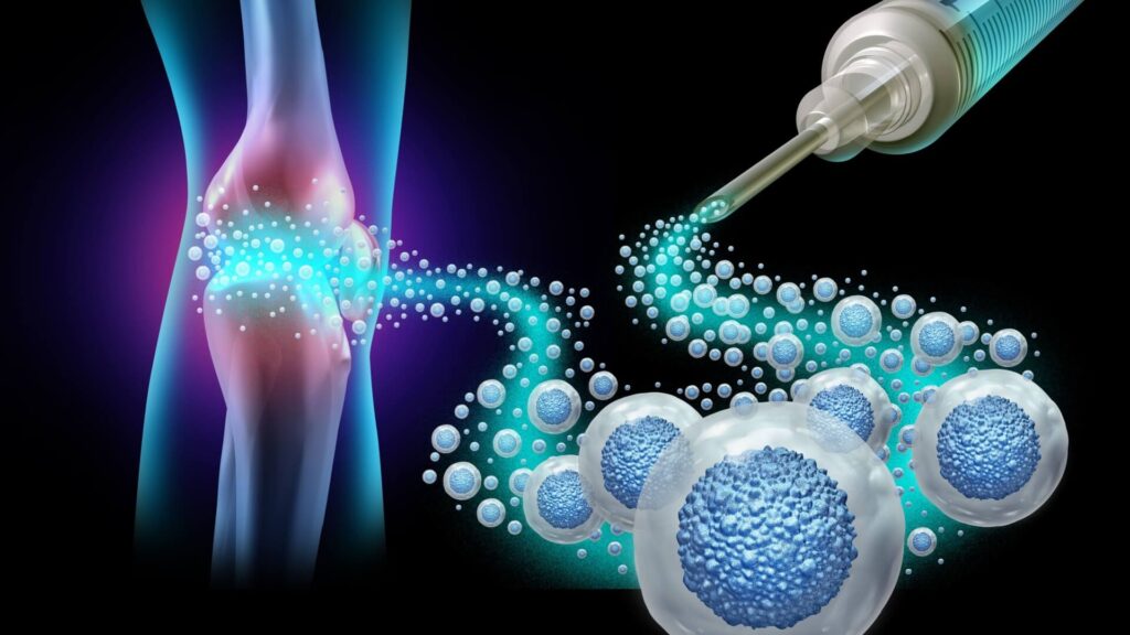 Would A2M Injection Therapy Work For You?